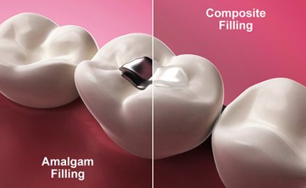 Restorative Dentistry 1